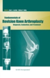 Fundamentals of Revision Knee Arthroplasty - Diagnosis, Evaluation, and Treatment